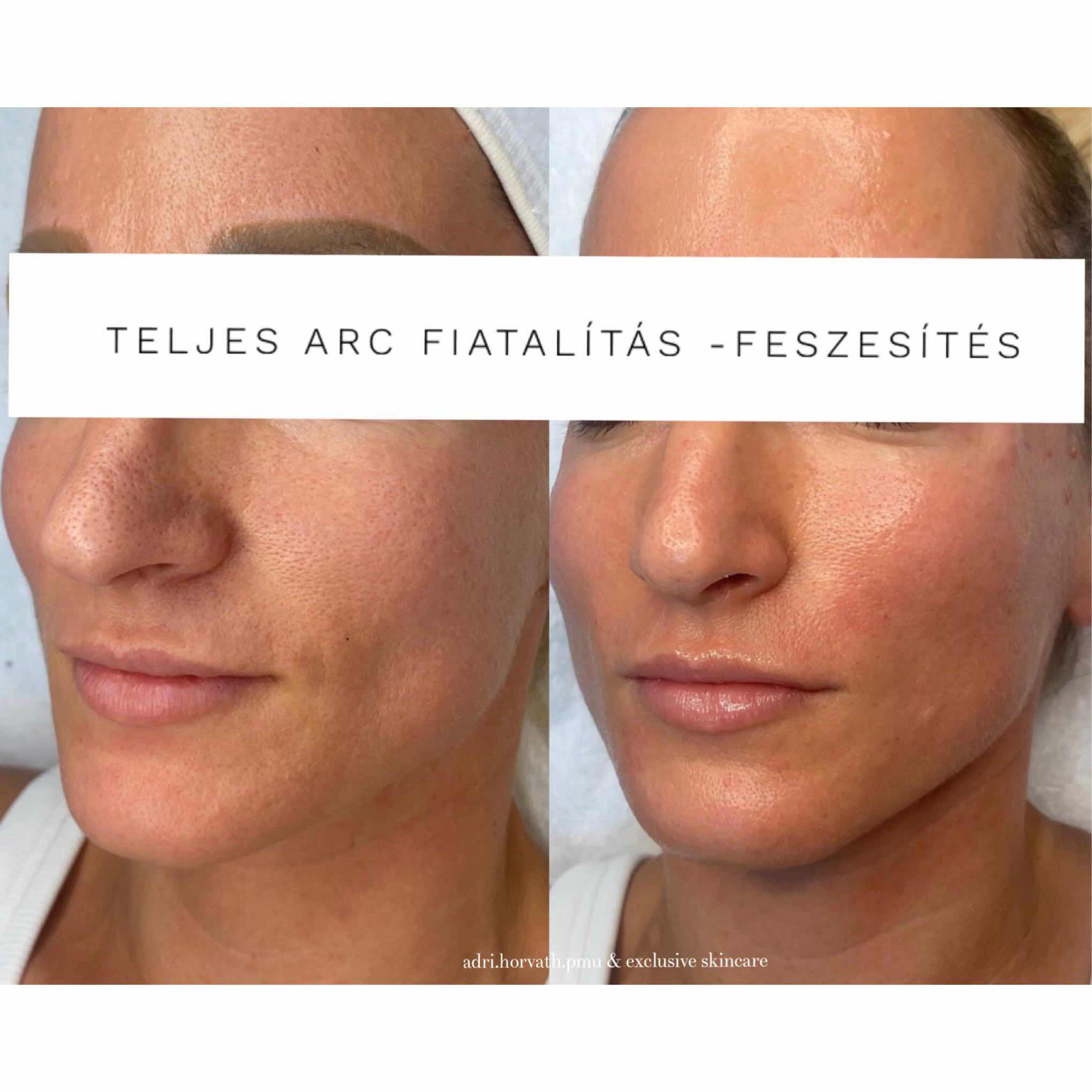antiaging arcfiatalitas2